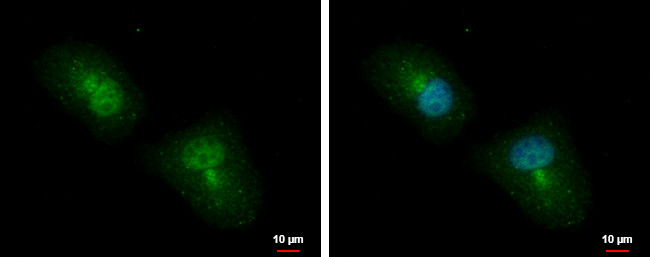 APBB2 Antibody in Immunocytochemistry (ICC/IF)