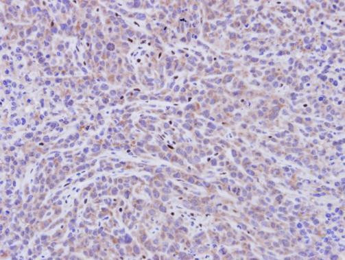 PDE11A Antibody in Immunohistochemistry (Paraffin) (IHC (P))