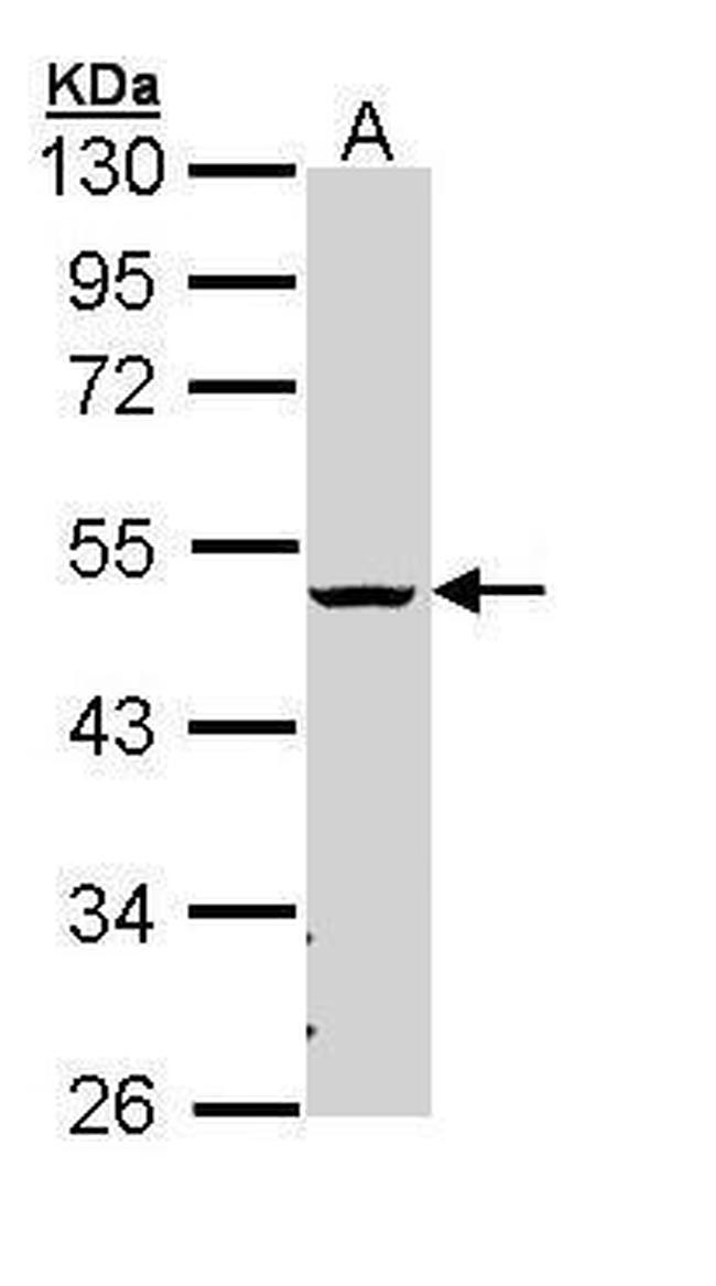 CHST5/CHST6 Antibody in Western Blot (WB)