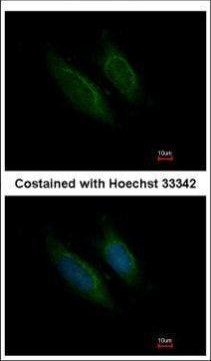 Factor X/Xa Antibody in Immunocytochemistry (ICC/IF)