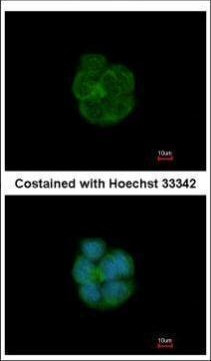 Cytokeratin 13 Antibody in Immunocytochemistry (ICC/IF)
