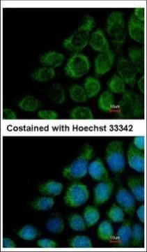 COG8 Antibody in Immunocytochemistry (ICC/IF)