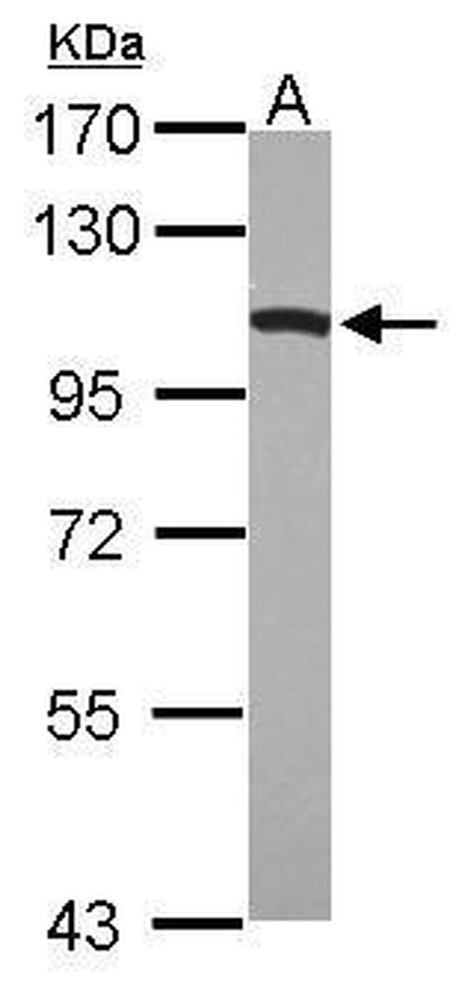 Dynamin 1 Antibody in Western Blot (WB)