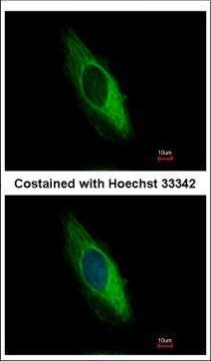 Cytokeratin 6 Antibody in Immunocytochemistry (ICC/IF)