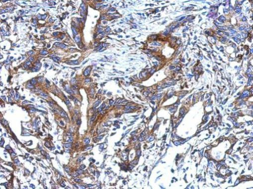 alpha-ENaC Antibody in Immunohistochemistry (Paraffin) (IHC (P))