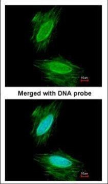 gamma Synuclein Antibody in Immunocytochemistry (ICC/IF)