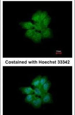 SMURF2 Antibody in Immunocytochemistry (ICC/IF)