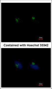 RGS11 Antibody in Immunocytochemistry (ICC/IF)