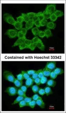 FRAT1 Antibody in Immunocytochemistry (ICC/IF)
