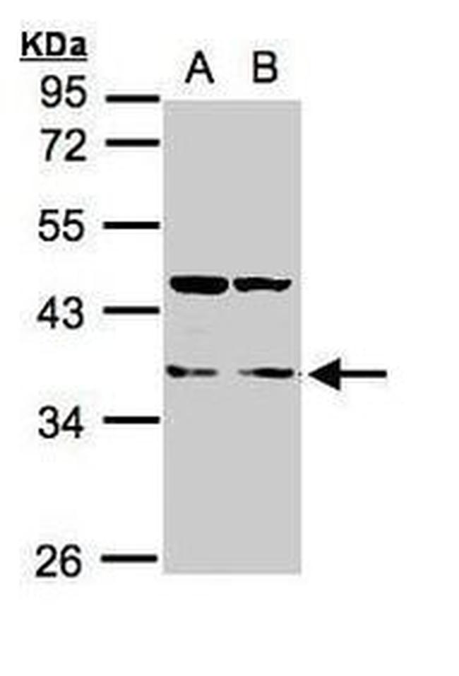 LIMS1 Antibody in Western Blot (WB)