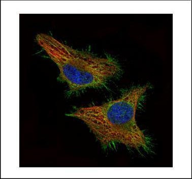 CSRP3 Antibody in Immunocytochemistry (ICC/IF)