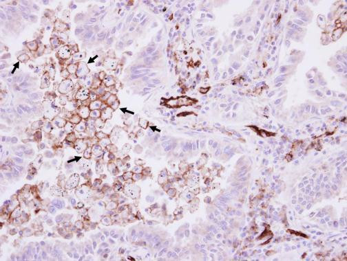 CD31 Antibody in Immunohistochemistry (Paraffin) (IHC (P))