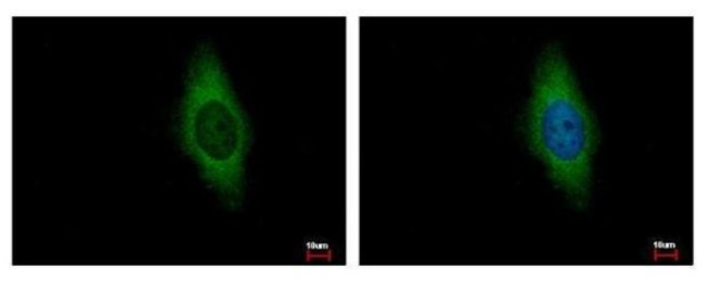Cdc6 Antibody in Immunocytochemistry (ICC/IF)