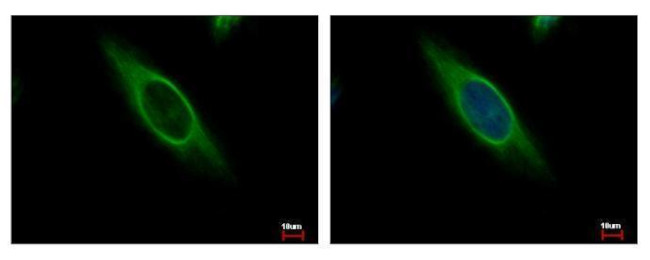 CAB39 Antibody in Immunocytochemistry (ICC/IF)