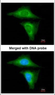 RBP4 Antibody in Immunocytochemistry (ICC/IF)