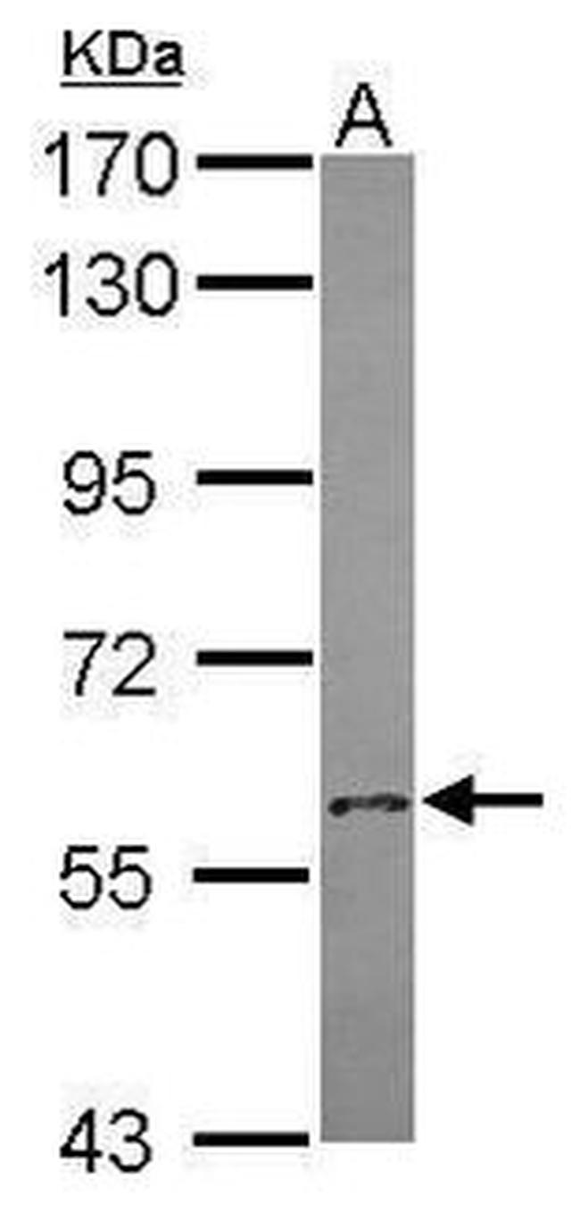 MOX1 Antibody in Western Blot (WB)