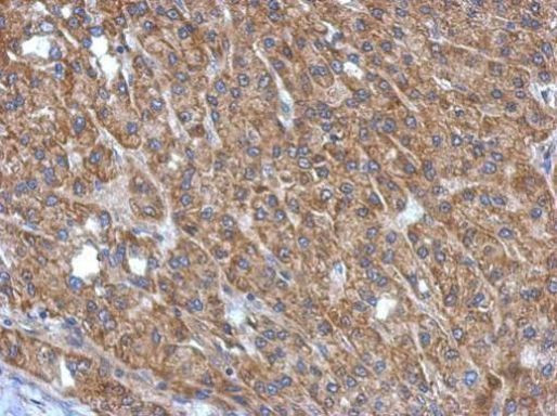 MAPKAP1 Antibody in Immunohistochemistry (Paraffin) (IHC (P))
