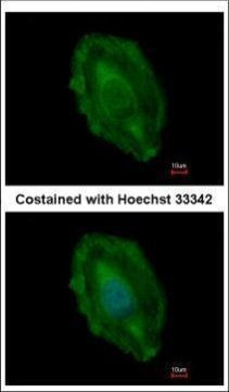 Aspartoacylase Antibody in Immunocytochemistry (ICC/IF)