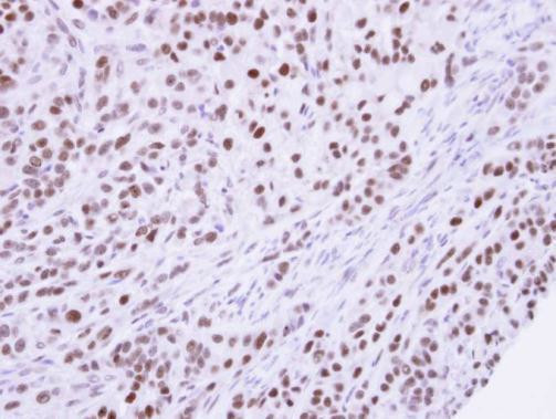 SUMO1 Antibody in Immunohistochemistry (Paraffin) (IHC (P))