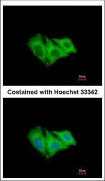 CK2 alpha-1 Antibody in Immunocytochemistry (ICC/IF)