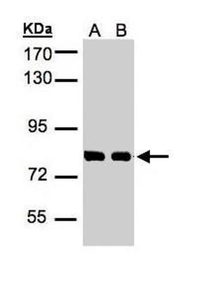 HEC1 Antibody in Western Blot (WB)