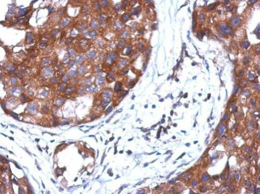 STAMBP Antibody in Immunohistochemistry (Paraffin) (IHC (P))