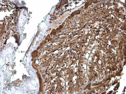 ATP6V1A Antibody in Immunohistochemistry (Paraffin) (IHC (P))