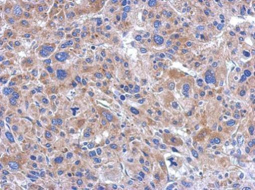 FASTKD5 Antibody in Immunohistochemistry (Paraffin) (IHC (P))