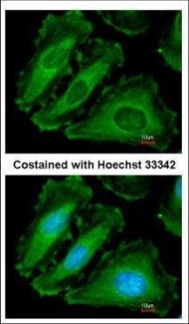 NALP2 Antibody in Immunocytochemistry (ICC/IF)