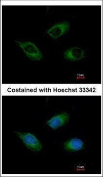 CIDEC Antibody in Immunocytochemistry (ICC/IF)