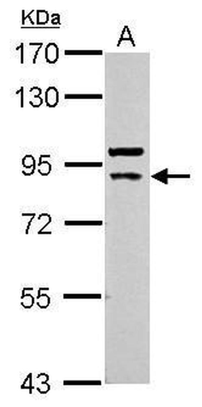 Cullin 5 Antibody in Western Blot (WB)
