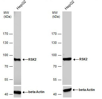 RSK2 Antibody in Western Blot (WB)