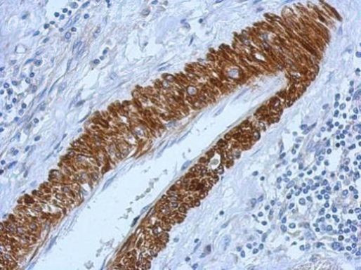 ACVR1B Antibody in Immunohistochemistry (Paraffin) (IHC (P))