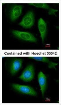 RIP1 Antibody in Immunocytochemistry (ICC/IF)