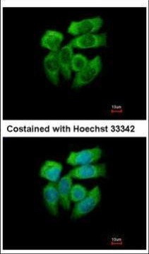 PAK1 Antibody in Immunocytochemistry (ICC/IF)