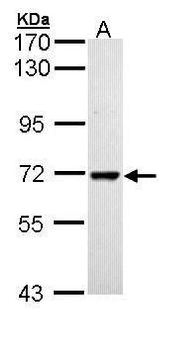PPIL2 Isoform B Antibody in Western Blot (WB)