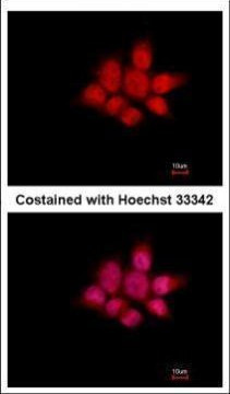 NCK1 Antibody in Immunocytochemistry (ICC/IF)