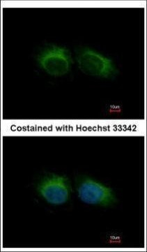 HIPPI Antibody in Immunocytochemistry (ICC/IF)