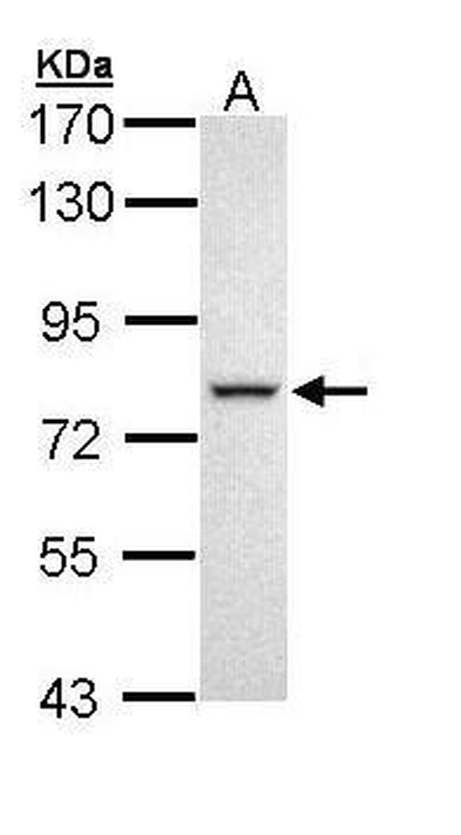DDX41 Antibody in Western Blot (WB)