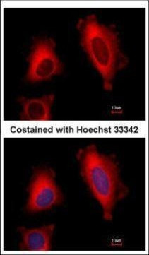EEF1D Antibody in Immunocytochemistry (ICC/IF)