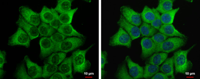 DVL2 Antibody in Immunocytochemistry (ICC/IF)