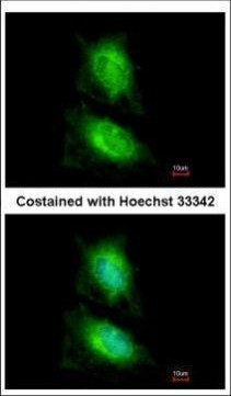 JIP2 Antibody in Immunocytochemistry (ICC/IF)