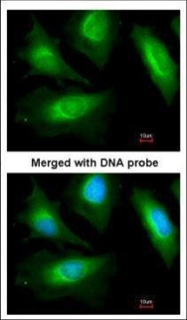 alpha Actinin 2 Antibody in Immunocytochemistry (ICC/IF)