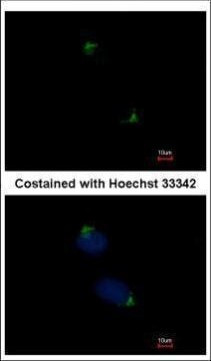 alpha Catenin Antibody in Immunocytochemistry (ICC/IF)