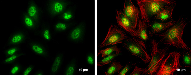 E-cadherin Antibody in Immunocytochemistry (ICC/IF)