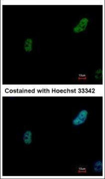 PRP19 Antibody in Immunocytochemistry (ICC/IF)