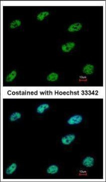 CtBP1 Antibody in Immunocytochemistry (ICC/IF)