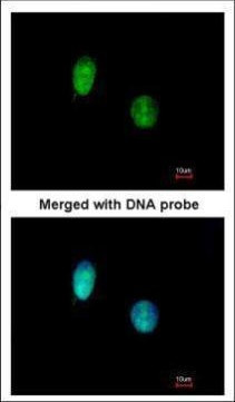 CtBP1 Antibody in Immunocytochemistry (ICC/IF)