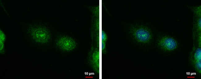 ErbB4 Antibody in Immunocytochemistry (ICC/IF)