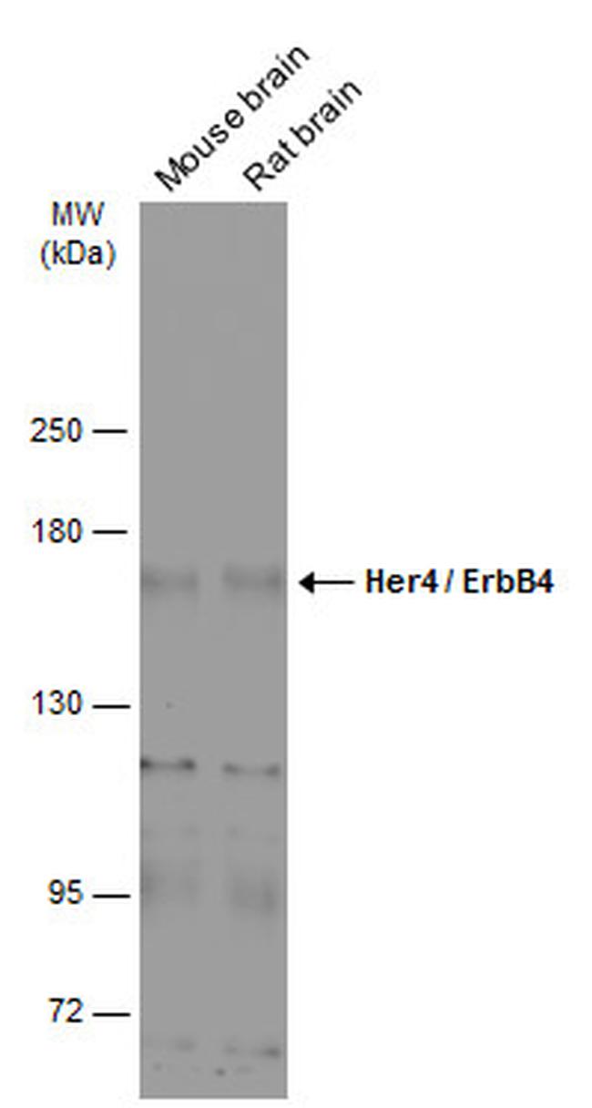 ErbB4 Antibody in Western Blot (WB)